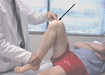 Боль в колене при сгибании является самой распространенной причиной, по которой люди посещают врачей-травматологов. 